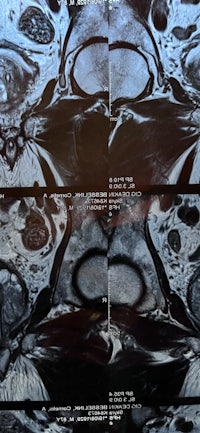 mri images of a patient's head and neck