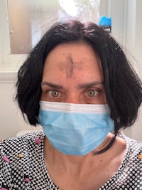 a woman with a surgical mask on her face