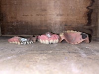 a group of teeth sitting on top of a wooden box