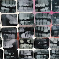 dental x - rays of teeth