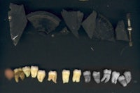 a collection of teeth and tools on a black surface